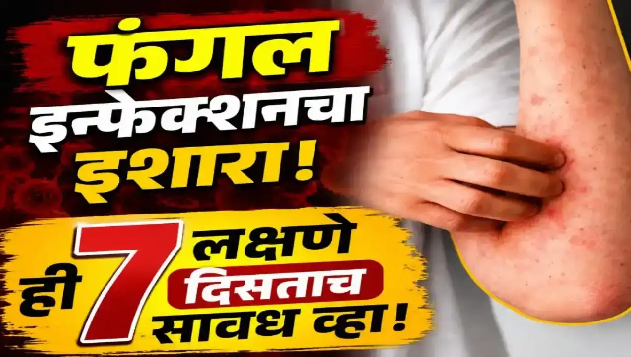 पावसाळ्यात फंगल इन्फेक्शनची सुरुवातीची लक्षणे दर्शवणारे त्वचेवरील लाल चट्टे आणि खाज