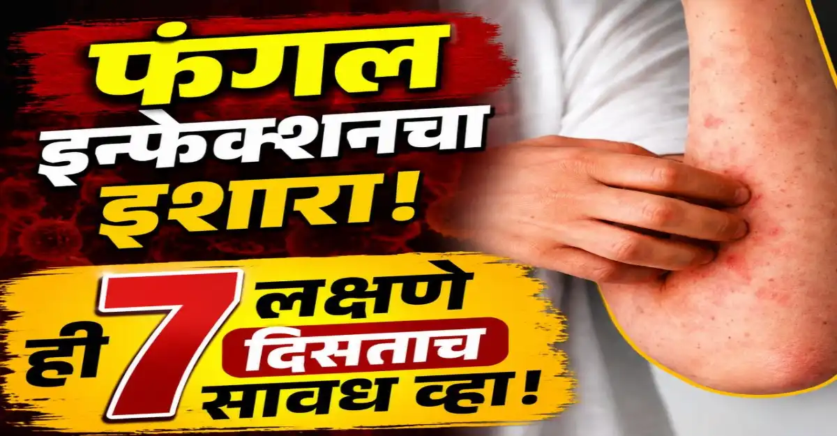 पावसाळ्यात फंगल इन्फेक्शनची सुरुवातीची लक्षणे दर्शवणारे त्वचेवरील लाल चट्टे आणि खाज
